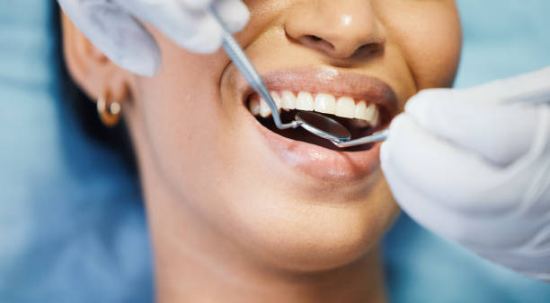 Best Emergency Dental Care for Broken or Chipped Teeth in Boulder Creek, CA