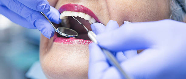 Best Emergency Dental Care for Broken or Chipped Teeth in Boulder Creek, CA